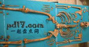 世界上怪异的骨架Top1：阉割的骨架