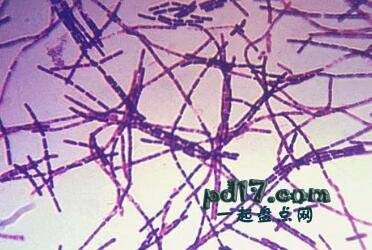 地球上最危险的细菌Top8：炭疽杆菌
