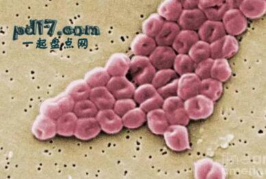 地球上最危险的细菌Top6：鲍氏不动杆菌