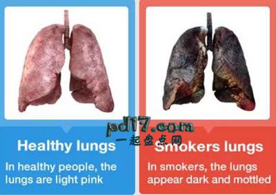 人类史上最致命的疾病Top5：气管，支气管和肺癌